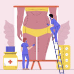 Lighter Tomorrow: A Comprehensive Guide to Financing Your Weight Loss Journey Weight Loss Surgery Insurance